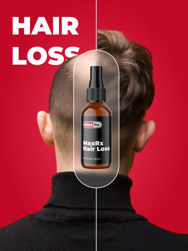 Male Hair Loss